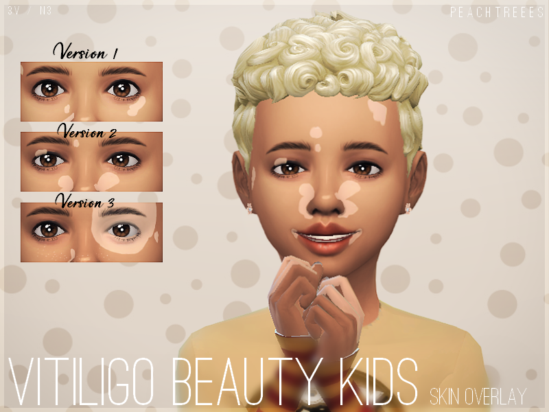 Détails de la peau vitiligo pour enfants